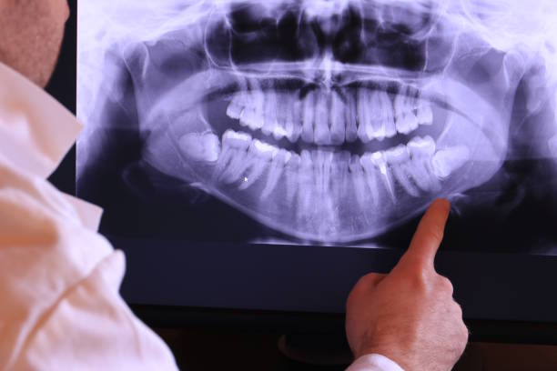 Best Emergency Dental Filling Replacement  in Youngsville, NC